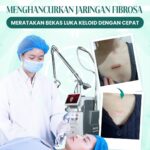 Tahukah kamu Keloid terbentuk ketika kulit memproduksi kolagen secara berlebihan selama proses p
